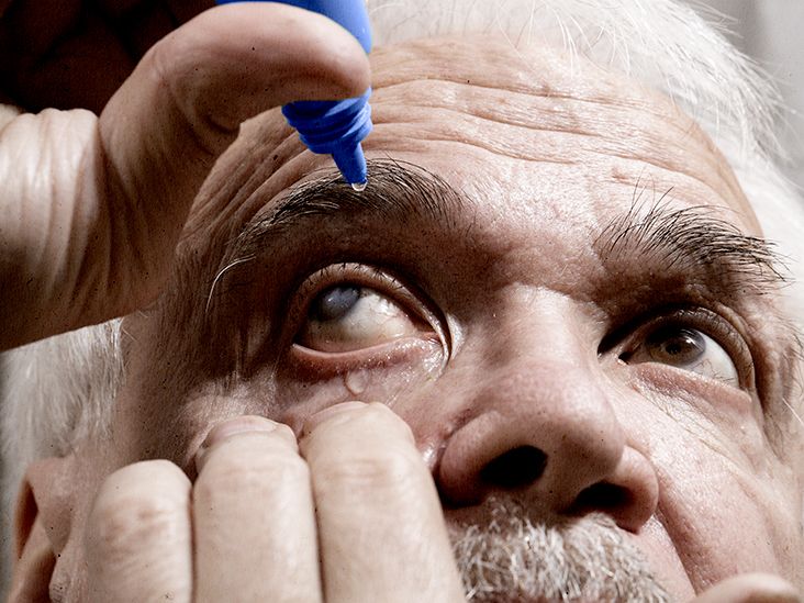 Dry eye gel drops: Uses, side effects, interactions, more