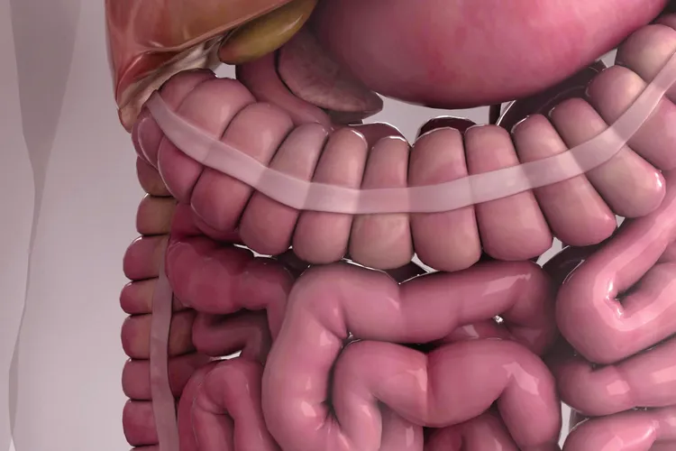 How UC Inflames Your Large Intestine