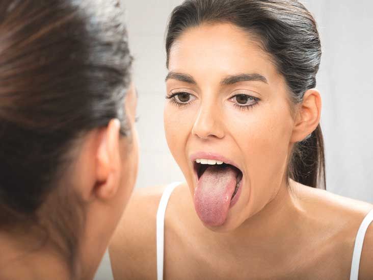 Bleeding Tongue: Treatment, Causes, and More