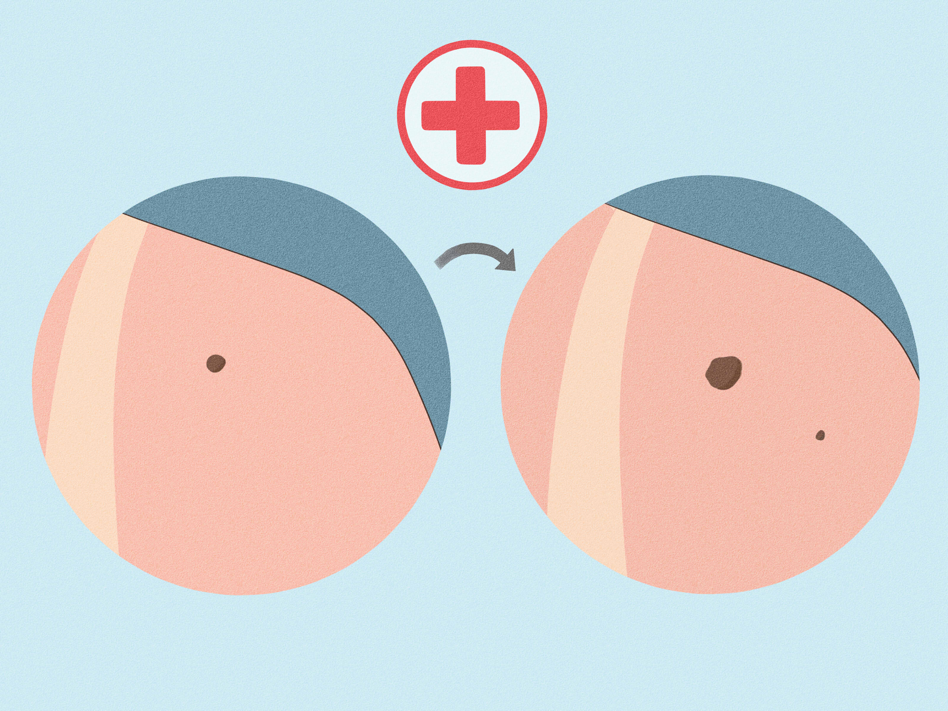 How to Get Fair Skin: Can Natural Remedies Help?